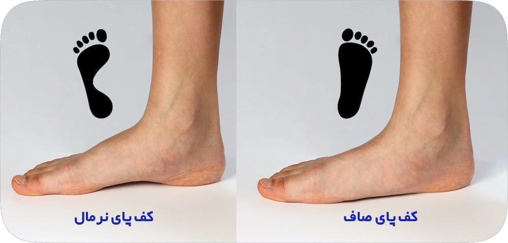 کف پای صاف